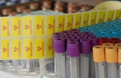 Cyprus detects three new coronavirus cases