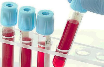 Blood test could help detect cancer in people with nonspecific symptoms