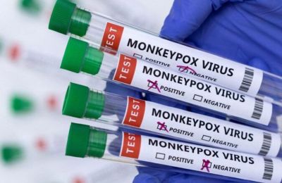 First monkeypox case detected in Cyprus