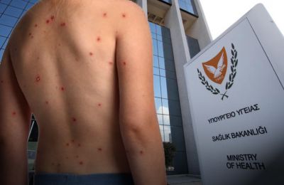 Cyprus detects two more cases of monkeypox