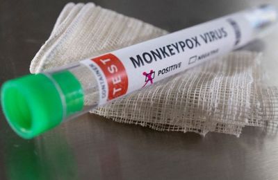 18 year old with no travel history diagnosed with monkeypox