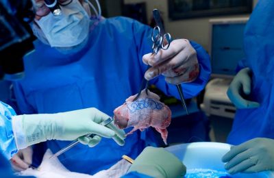 A pig deal: Gene-edited kidney gives new life. Photo credit: NYU Langone Health