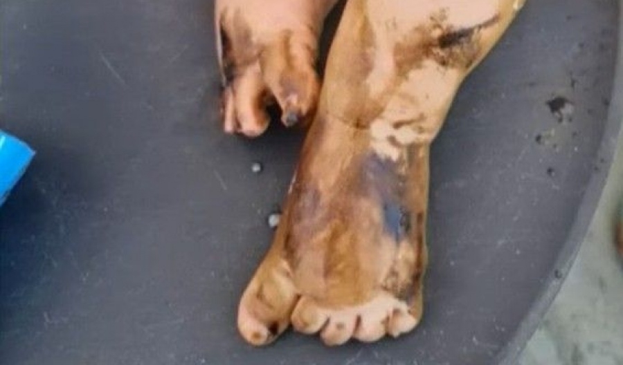 Leak in Moni port area prompts emergency cleanup; parents raise concerns over beach safety. Photo screen captured from OmegaLiveCy Youtube video