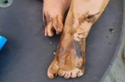 Leak in Moni port area prompts emergency cleanup; parents raise concerns over beach safety. Photo screen captured from OmegaLiveCy Youtube video