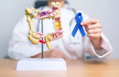 Free national screening program targets ages 50-74 with simple, at-home testing to save lives. Photo credit: Unsplash