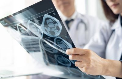 Wide gap remains across the European Union, with some countries reporting rates more than three times higher.