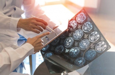 Patient advocates call for earlier diagnosis and better specialist training as global cases reach 3 million. Photo credit: Unsplash