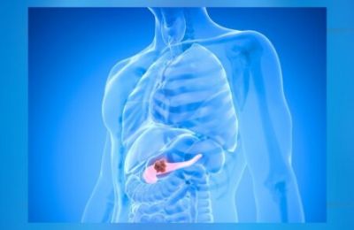 New pill offers hope against advanced pancreatic cancer