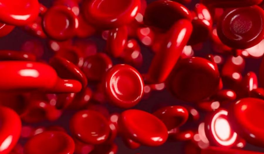 Iron-rich foods, supplements and other treatment options for restoring the body’s iron stores. Photo credit: Unsplash
