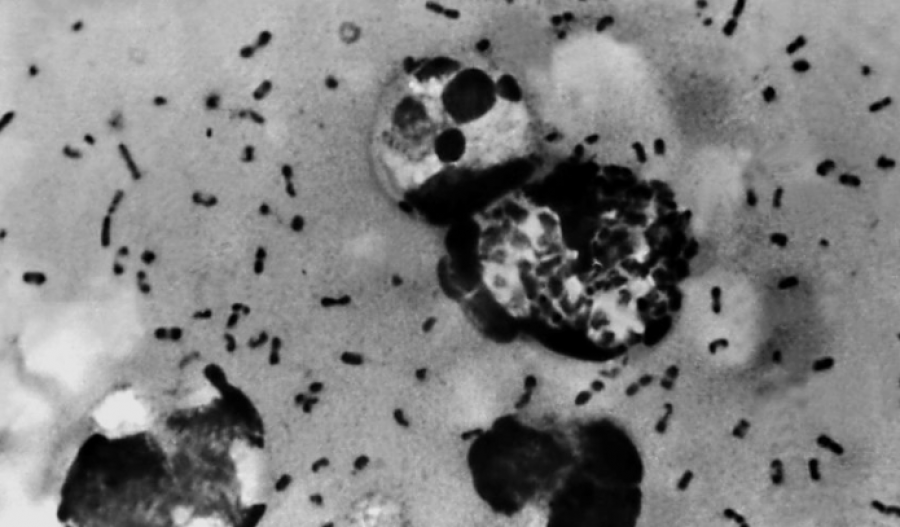 Suspected pneumonic plague investigated after Russian lab worker’s death
