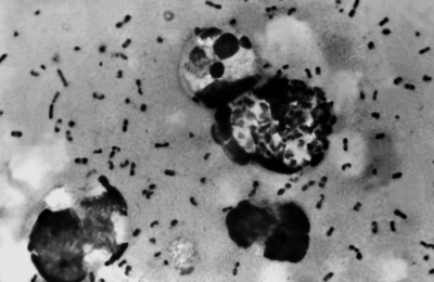Suspected pneumonic plague investigated after Russian lab worker’s death